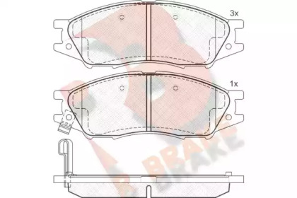 Комплект тормозных колодок R BRAKE RB1635